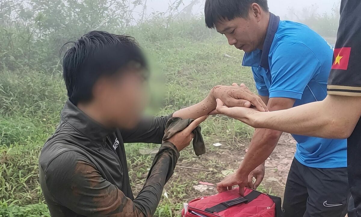Du khách trượt ngã, gãy tay khi leo núi Bà Đen ngày mưa
